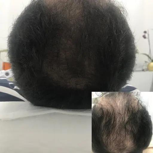 Özlem Koyuncu Güzellik Merkezi 4