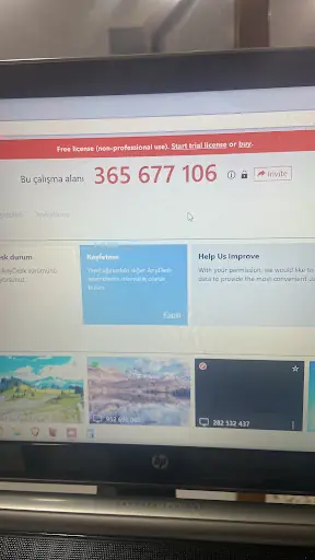 Kelkit Erkek Lazer Epilasyon