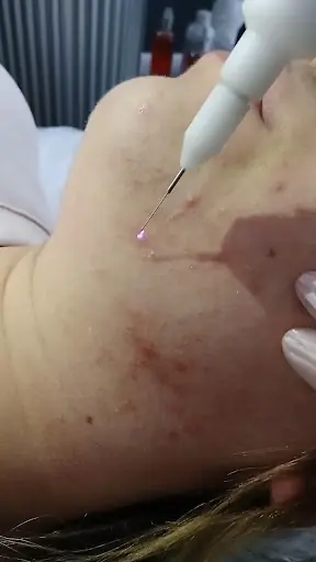 Karina Güzellik Kuşadası 3