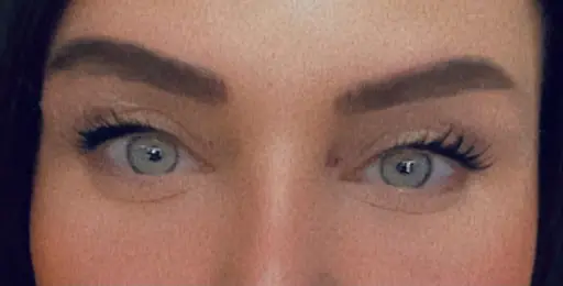 Mila Estetik 3