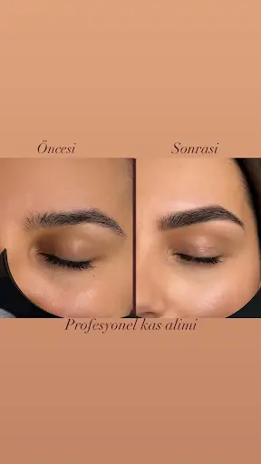 Damla Yıldız Beauty 3