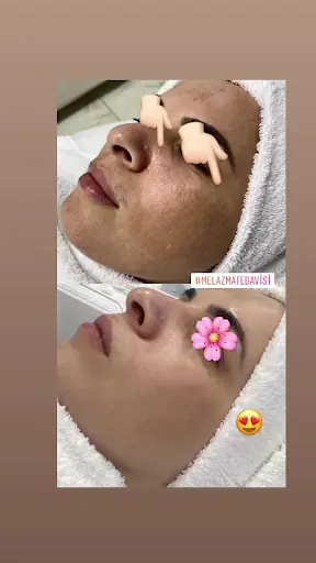 Başakşehir Estetik ve Güzellik Merkezi 4