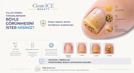 CleanICE Beauty