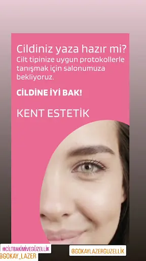 Gökay Lazer Güzellik 3