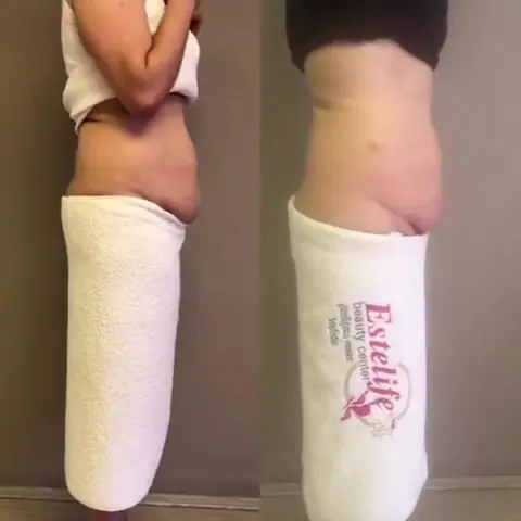 GÜLCAN KARADAĞ ESTELİFE BEAUTY 3