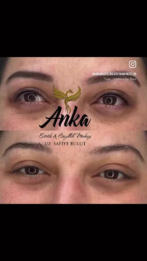 Anka Güzellik Lazer Epilasyon ve Kaş Tasarım Merkezi 4