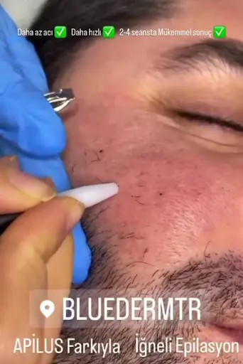 BLUEDERM GÜZELLİK MERKEZİ 3