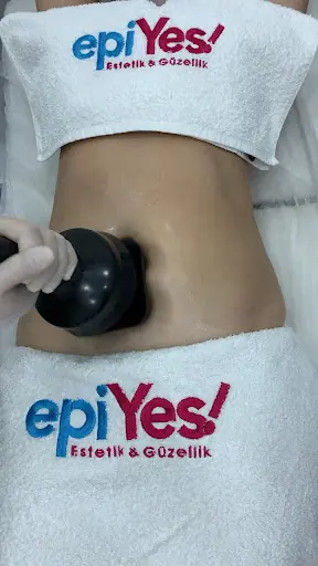 Epiyes Estetik Güzellik 2