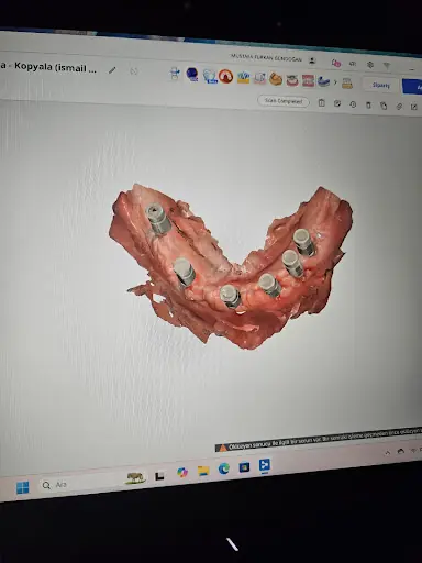 İvrindi Diş Kliniği 4
