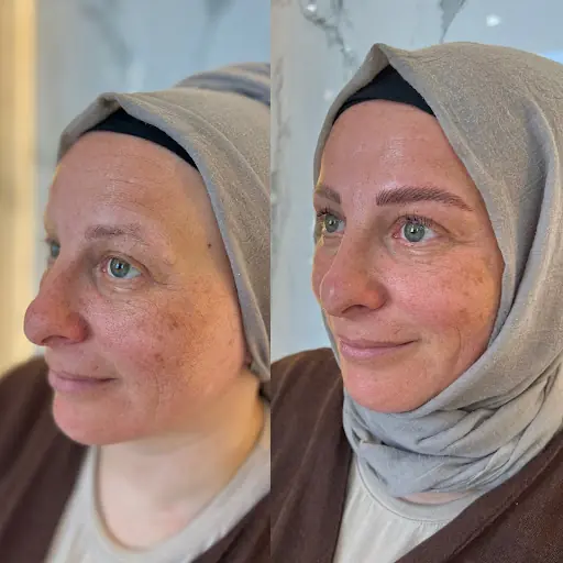 Dilek Sarıçiçek Güzellik Merkezi