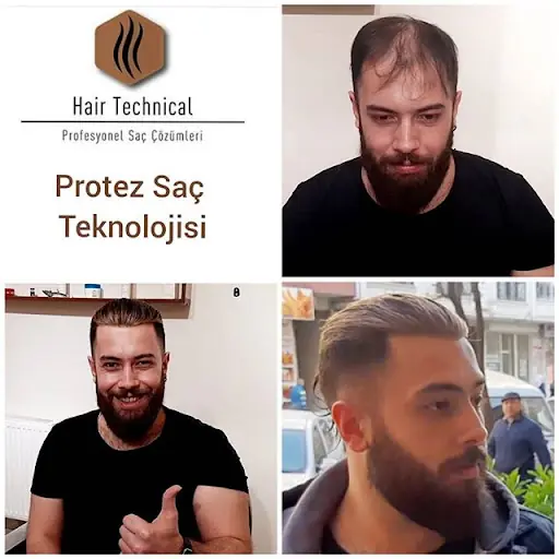HAİR TECHNİCAL PROTEZ SAÇ MERKEZİ 3