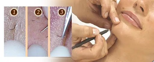 lotus beauty & slimming club 4