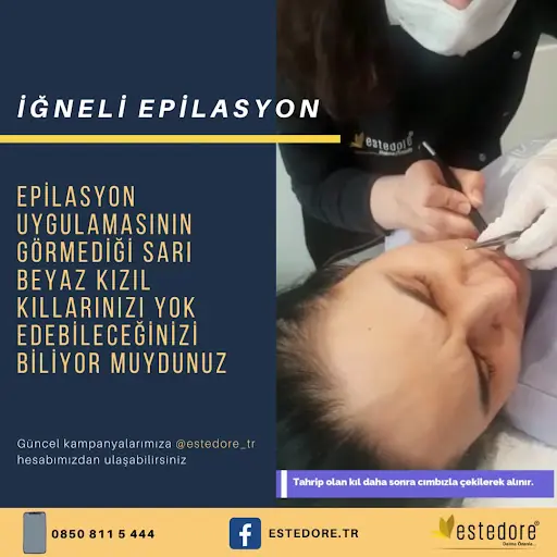 Estedore Beauty Palace Kartal | Epilasyon, Cilt Bakımı, Zayıflama 3