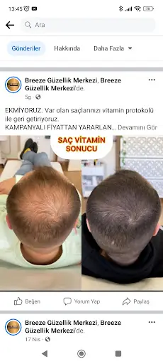 Breeze Güzellik Merkezi 4