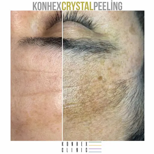 KONHEX CLINIC 3