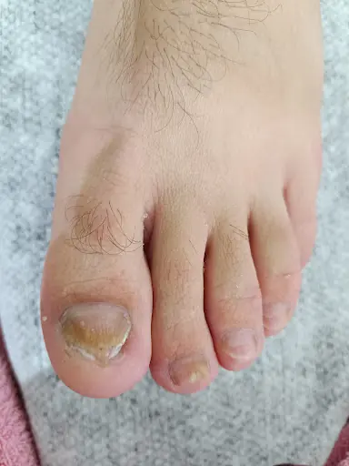 AFRODİT GÜZELLİK NUR YANARATEŞ