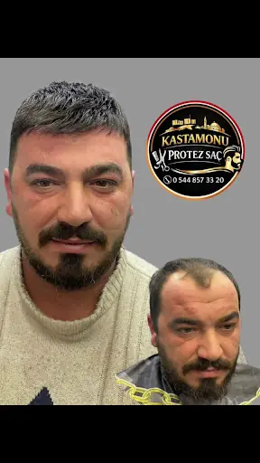 Kastamonu PROTEZ SAÇ MERKEZİ İlkadım 2