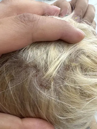 Burak Çınar Hair Studio 4