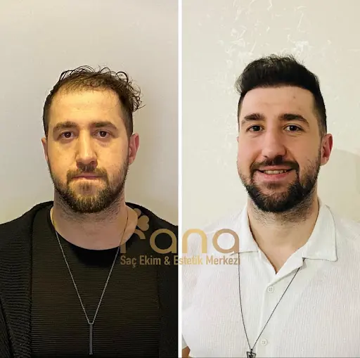 Rana Saç Ekim Danışmanlığı & Güzellik Merkezi 4