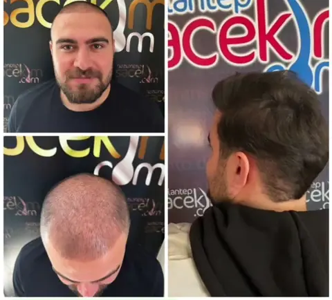 SİLOPİ SAÇ EKİM MERKEZİ 2