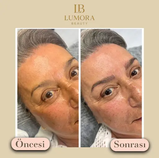 Lumora Beauty 4
