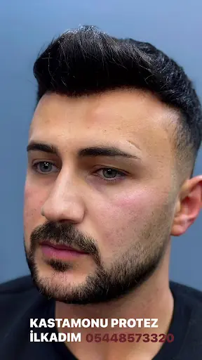 Kastamonu PROTEZ SAÇ MERKEZİ İlkadım 3