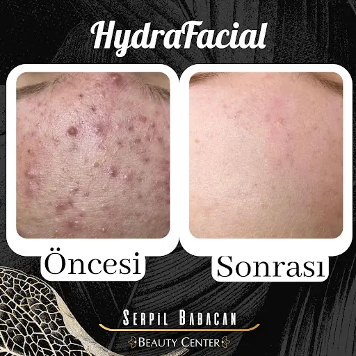 Serpil Babacan Kuaför & Beauty Center İstanbul Bostancı 4