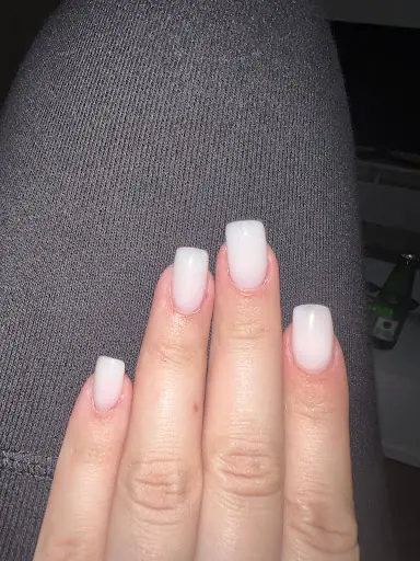 Asya Beauty Lazer Epilasyon Ve Estetik Çapa 3