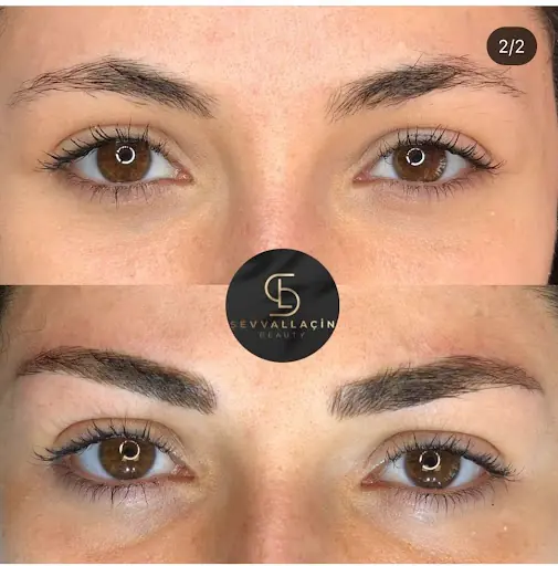 Şevval Laçin Beauty 2