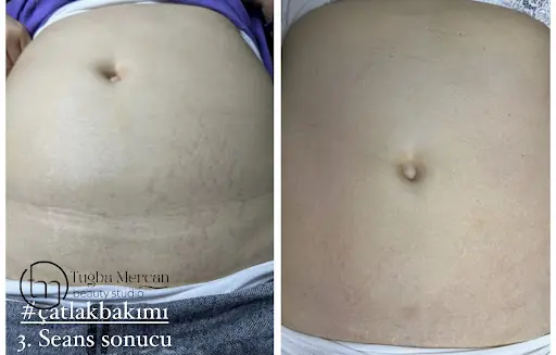 Tuğba Mercan beauty studio