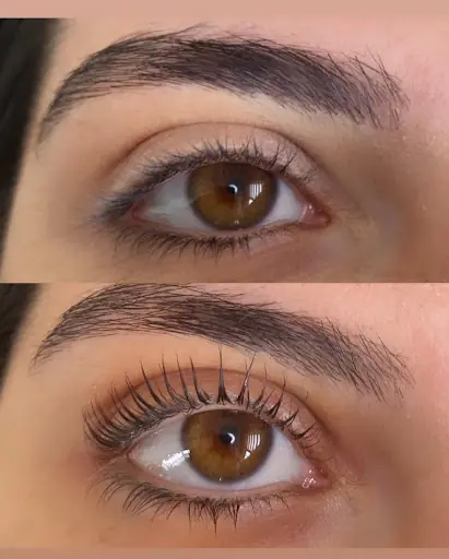 Pinar Beauty Studio – Lazer Epilasyon, İstanbul (4. fotoğraf)