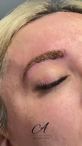 Aysel Çetinalp Kadıköy İğneli Epilasyon & Lazer Epilasyon 3