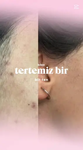 Aura Güzellik Salonu. .guzelik merkezi 3