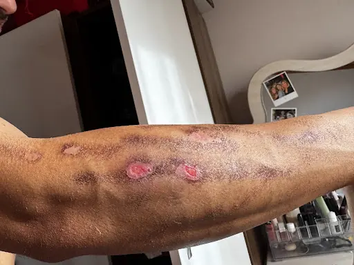 Renew Beauty Kadıköy | Cilt Bakımı, Lazer Epilasyon, Zayıflama ve Kaş Tasarım