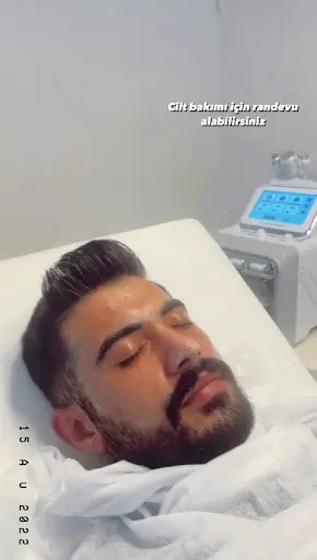 Ömer turhan hair design – Lazer Epilasyon, İstanbul (4. fotoğraf)