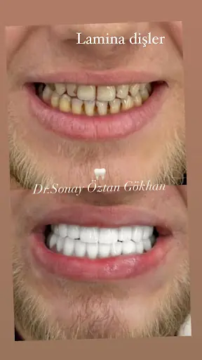 Sonay Öztan Gökhan
