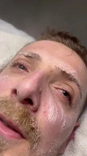 Mehmet ER 3