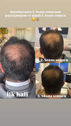 İlayda Gözel Beauty – Lazer Epilasyon, İstanbul (3. fotoğraf)