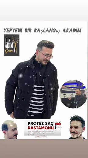 Kastamonu PROTEZ SAÇ MERKEZİ İlkadım 5