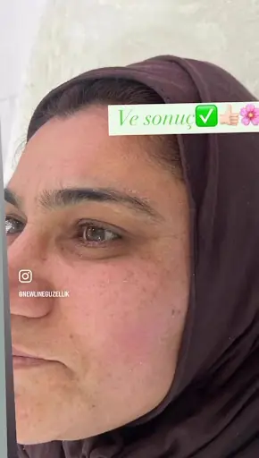 Midyat New Line Estetic Güzellik Salonu 3