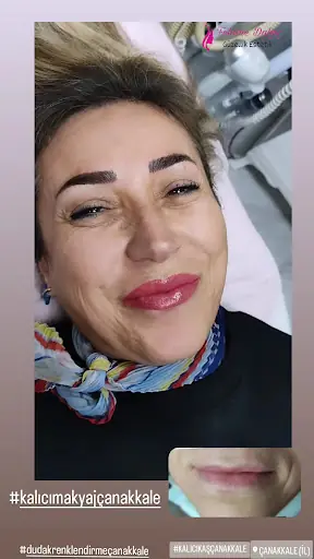 Fehime DALGIÇ Güzellik Estetik 3