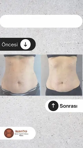 Haristes Sağlıklı Yaşam ve Güzellik Merkezi 3