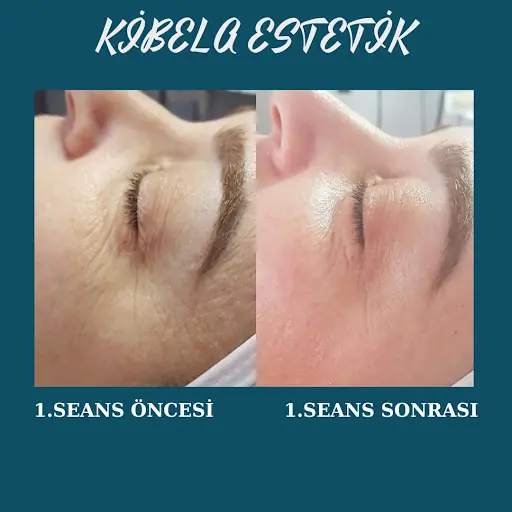 Kibela Güzellik Merkezi 4