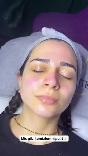 Nisa Güzellik Salonu – Lazer Epilasyon, İstanbul (3. fotoğraf)
