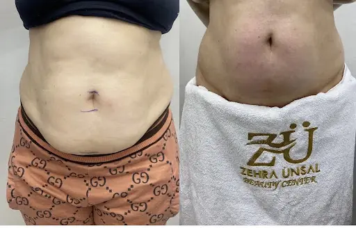ZEHRA ÜNSAL GÜZELLİK SALONU 3