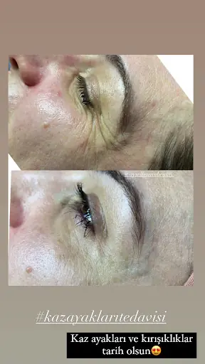 Aysel Baran Güzellik Salonu