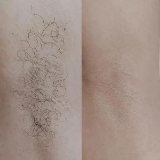 ALTIN BEAUTY (GÜZELLİK SALONU) 3