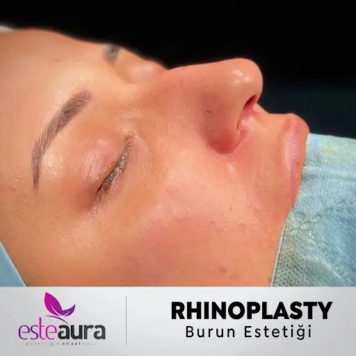 Estetik ve Plastik Cerrahi Merkezi - Esteaura 3