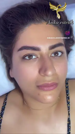 Anka Güzellik Lazer Epilasyon ve Kaş Tasarım Merkezi 3