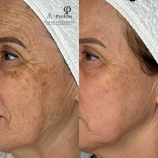 Fidangör Beauty Lounge 4